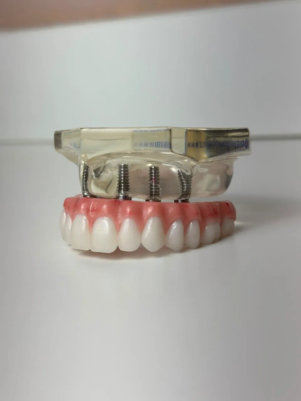 O que são as próteses dentárias